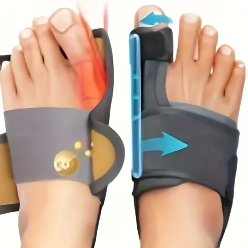 Adjustable Bunion Corrector Splint